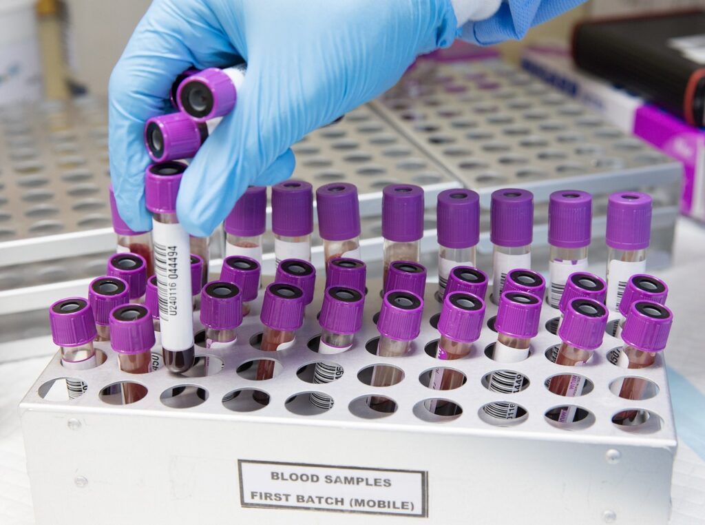 Medical Laboratory Scientist sorting EDTA bottles