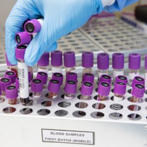 Medical Laboratory Scientist sorting EDTA bottles