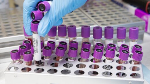Medical Laboratory Scientist sorting EDTA bottles