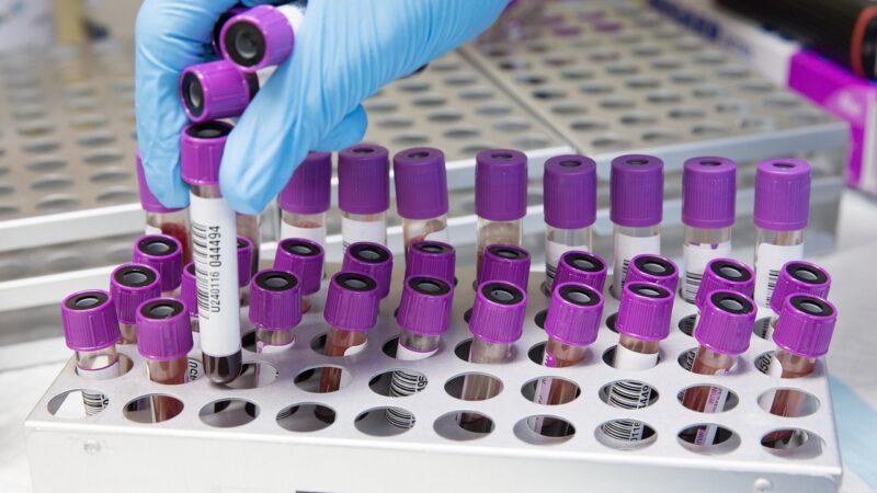 Medical Laboratory Scientist sorting EDTA bottles