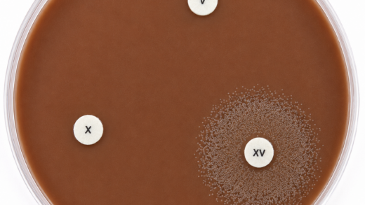 Factor X and V in chocolate agar