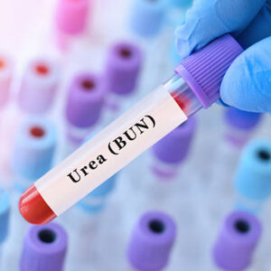 urea blood test for kidney function assessment and metabolic waste evaluation with doctor holding laboratory sample tube during clinical diagnostics and biochemical analysis in medical laboratory