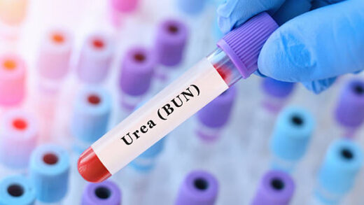 urea blood test for kidney function assessment and metabolic waste evaluation with doctor holding laboratory sample tube during clinical diagnostics and biochemical analysis in medical laboratory