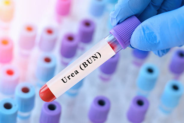 urea blood test for kidney function assessment and metabolic waste evaluation with doctor holding laboratory sample tube during clinical diagnostics and biochemical analysis in medical laboratory